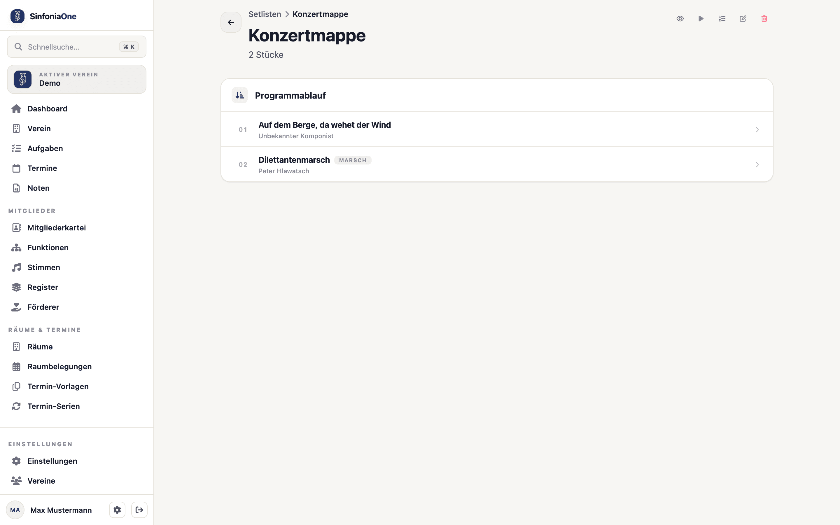Setlist-Export (SetlistDetailScreen) mit Auswahl Inhaltsverzeichnis, Druck-PDF und Spiel-Bundle